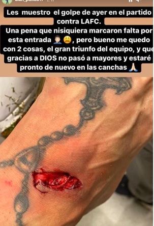 210627brutal1